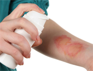 Burn Injuries